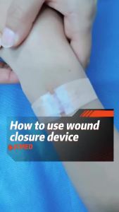HNKMP | Zipper Band Aid Painless Wound Closure Patch Sutureless Adhesive Dressing Breathable Bandage for Home Travel Office Use