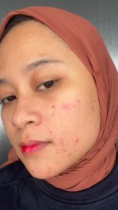 Garnier Bright Complete Acne Booster Serum 30ml: Serum Yang Mencerahkan Dan Anti Jerawat Menyamarkan Noda Jerawat