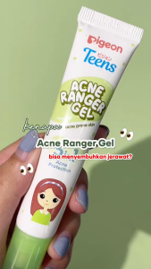 PIGEON TEENS ACNE RANGER GEL 15ml | Acne Gel Remaja| Gel Totol Jerawat| Kulit Kemerahan dan Berjerawat| Tea Tree Oil