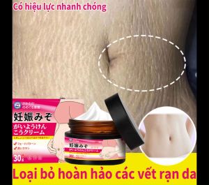 Kem làm mờ rạn da Kem xóa vết rạn da kem rạn da phụ nữ sau sinh làm mờ vết rạn căng da sẹo mờ sẹo ngừa sẹo kem làm trắng da 30g