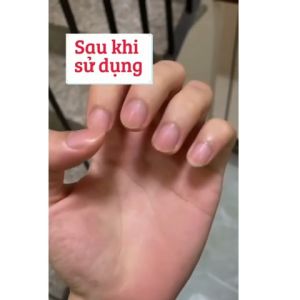 Tinh chất EELHOE phục hồi móng bị nấm đổi màu phục hồi móng khỏe mạnh