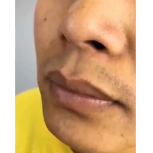 Stainless Steel Nose Hair Trimmer Clipper Cutter Gunting Rambut Wax Cabut Bulu Hidung Cordless Beard Shaver Razor Blade