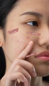 OMG Oh My Glow Panthenol + Ceramide Moisture Gel 30g - Pelembab Wajah - Moisturizer