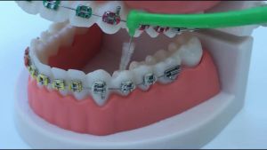 20Pcs Sikat Sela Behel Gigi Interdental Brush Bengkok Bentuk L Sikat Interdental Orthodontic