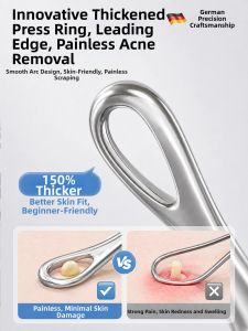 IMLUCKY | Precision Ultra Fine Double-Ended Blackhead Tool