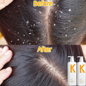 amino acid dandruff shampoo kelemumur hair care oil control anti dandruff syampoo kelemumur suitable oily hair kono 控油去屑轻盈洗发水Kono抖音同款500ML