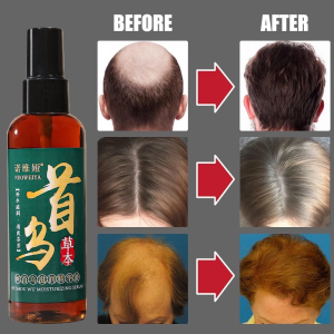 Gray Hair Reduction Roots Booster Tonic Prevents Balding Hair Growth Supplement Strengthening Hair Growth Serum
