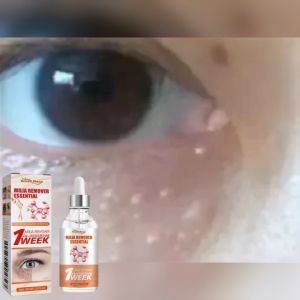 【Favorable Discount】South Moon Milia Remover Essential Fat Granules eye Bags Anti-Particles Puffiness To Firm Wrinkles & Reduce Dark Circles 30ml
