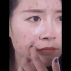 COD - Krim Penghilang Jerawat Plant Extraction Repair: Acne Extract Face Care