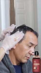 Nanmei Shampoo Anti Ketombe Gatal Penghitam Dan Penghilang Rambut Uban Di Usia Muda Permanen