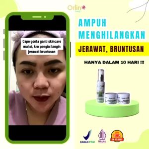 Paket Skincare Acne Hemat Orlin Beauty Merawat Wajah Kulit Sensitif Bekas Berjerawat Flek Hitam Bpom