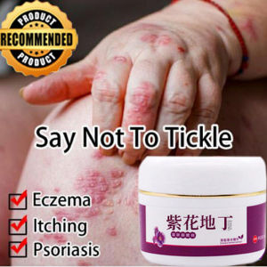 skin itch cream skin itch medicine 30g Herbal formula effectively prevents bacteria and quickly relieves itching Safe and no side effects