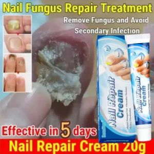 Penghilang Jamur Kuku & Perawatan Kuku Rusak: Memperbaiki Kuku Anda dengan Nail Repair Tempel & Serum Original