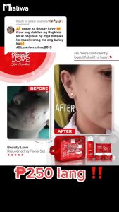 Beauty Love Rejuvenating Set Pampaputi Whitening Exfoliating Moisturizing Hydrating Beauty Skin Care Kojic Soap Toner Sunblock Sunscreen Night Cream Moisturizer Pimple Acne Pore Dark Spot Pekas Melasma Scar Blemishes Anti Aging Glass Skin For Men & Women