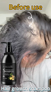 Ginger Shampoo Anti off shampoo ，Promote hair growth strong hair root ，Silky Supple Moisturize Hair  Repair Hair Loss，control oil Relieve itchy，200ml