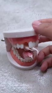 1200 Butir Temptooth Penambal Gigi