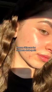 อานัว ANUA Niacinamide 10% Dark Spot Correcting Serum 30ml ไนอาซินาไมด์ เซรั่มบํารุงผิวหน้า เซรั่มปรับผิวใส Reduce dark spots