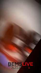 Switch Assembly Universal GREY for eBikes & Motorcycles DISC BRAKE TYPE - PAIR / Left Only / Right Only