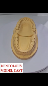 Ordento Dentolous Model Cast