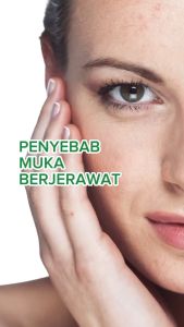 Sabun QM Brightening | Antiseptik | Anti Acne