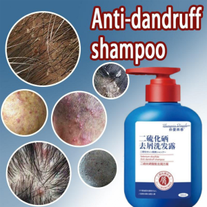 Selenium-Rich Anti-Dandruff Shampoo Soothes Itchy Scalp Anti-Mite HairCare Improves Fluffy Hair Texture Anti-Itch Shampoo