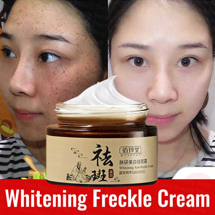 30g Whitening melasma cream Freckle Removing Cream pekas cream original japan  Remove Wrinkles Cream Pekas Remover Cream Blemish Cream Remove Melasma Freckles Anti Aging Serum Sunburn remove dark spot on face pikas remover cream Moisturizing Cream