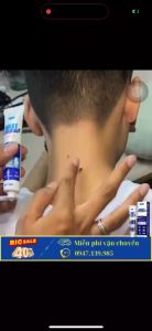 [Chính Hãng] Kem Tẩy Mụn Thịt Mụn ruồi Tàn nhang  Đồi mồi Nhập Khẩu Chính hãng 20g - OUHOE WART REMOVER