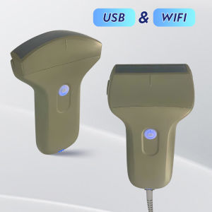 80E Full Digital Ultrasound Imaging Diagnostic Instrument Convex Array / Linear Array Color Ultrasound
