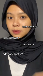 Mask Kerith Glasskin Glow Perfect Masker Wajah 40 Gr Pencerah Kulit Bebas jerawat Flek Hitam Bintik Bintik Glowing