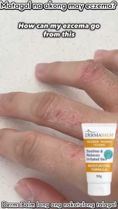 DermaBalm Skin Cream 50g