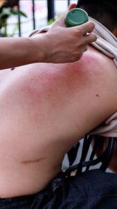 Kem xoa bóp giảm đau xương khớp vai gáy giảm bầm tím bong gân - Gel massage Hobi có 6 đầu con lăn ion mát xa Con lăn massage từ tinh dầu gừng ngải cứu