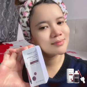 West Month Intensive Peeling Solution Soothes Skin Softens Texture Refines Pores Appearance Skin Care 30ml
