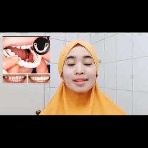 Snap On Smile Original Asli Atas Bawah Untuk Gigi Ompong Perawatan Kesehatan Gigi Palsu Renggang 1 Set