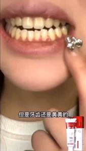 KEM TRẮNG RĂNG SP4 YAYASHI LÀM SẠCH MẢNG BÁN GIẢM Ố VÀNG PHỤC HỒI MEN RĂNG- LECARO