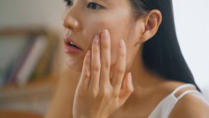 23YearsOld BADECASIL PLUS P 20g Acne Control Evening Cream