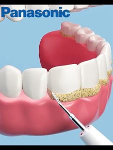 🦷แปรงสีฟันไฟฟ้า ที่ขูดหินปูน ขจัดคราบผิวฟัน เครื่องขูดหินปูน 🦷แปรงฟันและทำความสะอาด2ใน1 ปรับได้ 6 โหมด ไม่เจ็บเหงือก ทำความสะอาดล้ำลึก