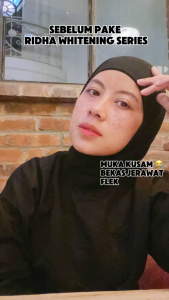 Ridha Paket Whitening Series isi 4 item (Skincare) Free Hijab