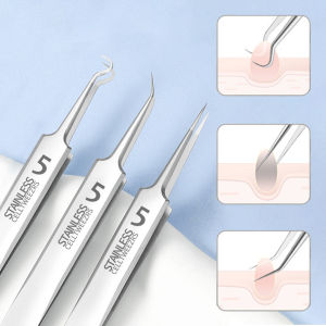 3/5pcs Set ﻿Stainless Steel Cell Forceps Laboratory Tweezers Blackhead Extraction Pimple Remover Suitable Clean Care Tools