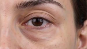 Peptide Lifting Eye Tightener Cream Caffeine Niacinamide Hyaluronic Acid Retinol Bee Venom Easy-Wear Formula 20g