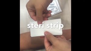 Medical Wound Closure Dressing Wound Bandage First Aid Wound Skin Closure Surgical Tape Sterile Wound Dressing Postpartum Wound Repair Steri Strip Skin Repair