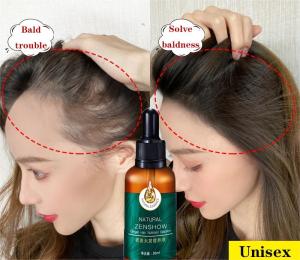 Hair Care Essential Oil 30ml Hair Growth Serum Hair Growth Oil Hair Oil Hair Serum Hair Loss Treatment Ginger Hair Growth Fluid Hair