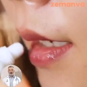 Kem trị hạt fordyce Sumifun cung cấp độ ẩm cho môi  làm hồng môi cải thiện tình trạng khô nứt rạn môi