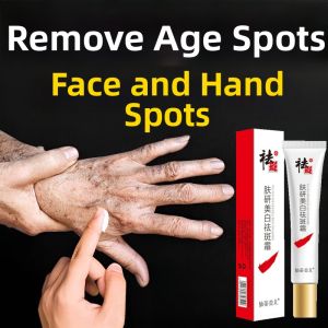 Age Spot Removal Cream
