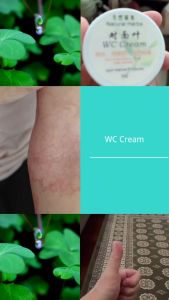 🌿 WC 草本修复药膏【Winged Cassia Herbal Cream】 纯植物草本配方 · 抗炎修复 · 祛疹止痒 · 温和无刺激