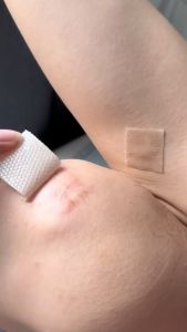 🔥ของแท้🔥Dr Jungle แผ่นแปะลบรอยแผลเป็น 4*150cm รอยแผลเป็น แผลเป็น แผ่นแปะซิลิโคนลดรอยแผลเป็น ซิลิโคนเจลสำหรับแผลเป็นจากการผ่าตัดคลอดและไทรอยด์ ช่วยลบรอยแผลเป็น เหมาะสำหรับแผลเป็นจากการผ่าตัดและรอยแผลเป็นทุกชนิด