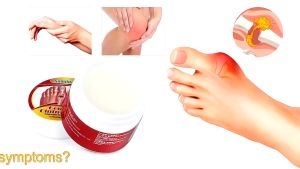 Cao bôi gout Gout Balm Raw Solution Bunion Pain Relief Paste
