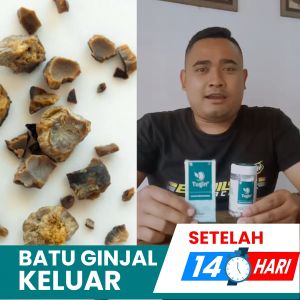 Obat Herbal Batu Ginjal Tugingo Paket Hemat Original BPOM Halal Cina Paling Yang Ampuh Tanpa Operasi Dan Sakit Pinggang