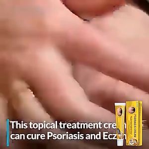 Psoriasis Skin Moss Removing Cream Eczema Ointment Psoriasis Cream Herbal antibacterial cream Anti-itch Relief Eczema Skin 20g