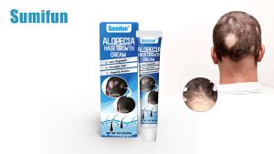 Sumifun Alopecia Hair Growth Cream - 20g Hair Growth for Men and Women - Haircare Comfort
