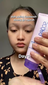 SCORA Gentle Low PH Cleanser Salicylic & D‑Panthenol - Hasil Bersih & Lembap dalam 14 Hari